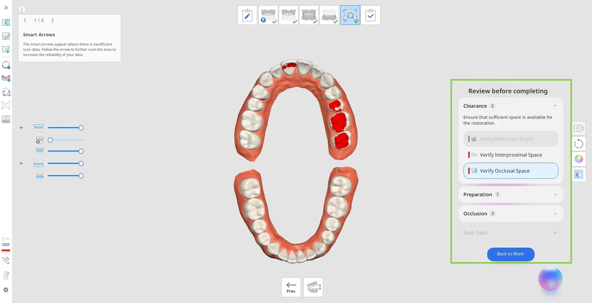 Medit Realtime Intelligence Moves Quality Control Into the Scan—But What Has Actually Been Validated?